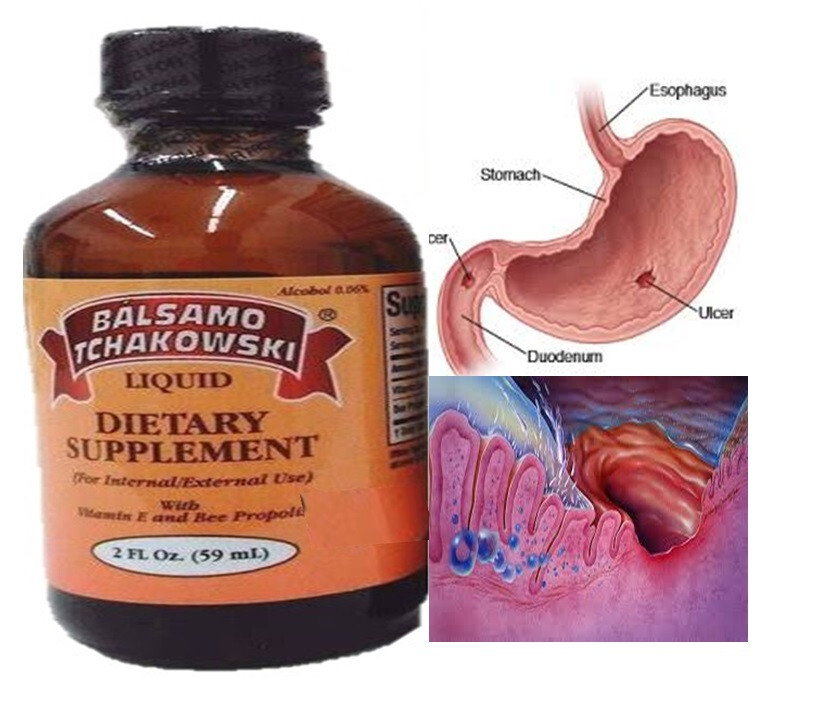 BALSAMO TCHAKOWSKI LIQUID DIETARY SUPPLEMENT 2 FL STOMACH ULCER PAIN RELIEF