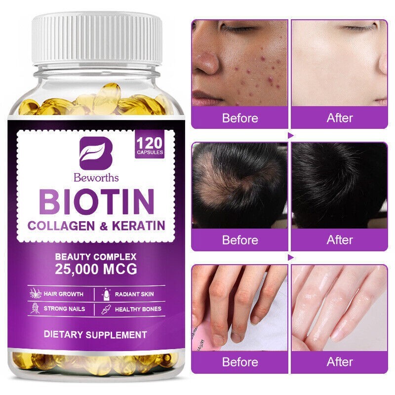 1-5x Hair Growth Dietary Supplement with Collagen Complex 60/120/600 Capsules