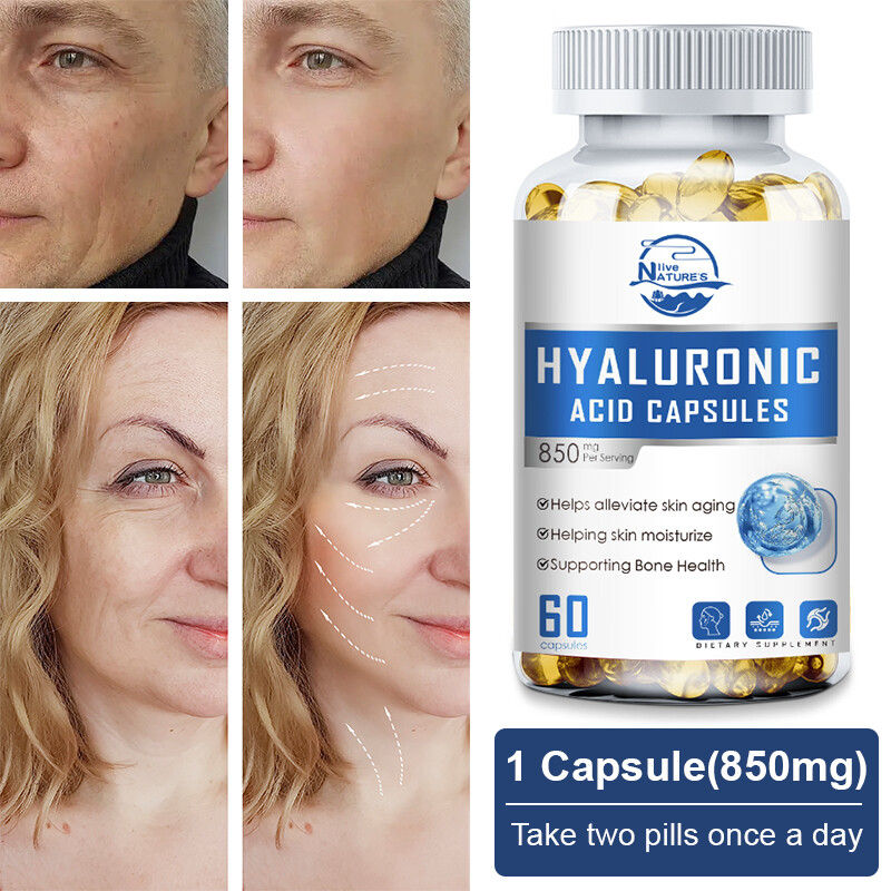 Hyaluronic Acid with MSM – 1000mg Joint & Skin Support – 60 Capsules | Non-GMO