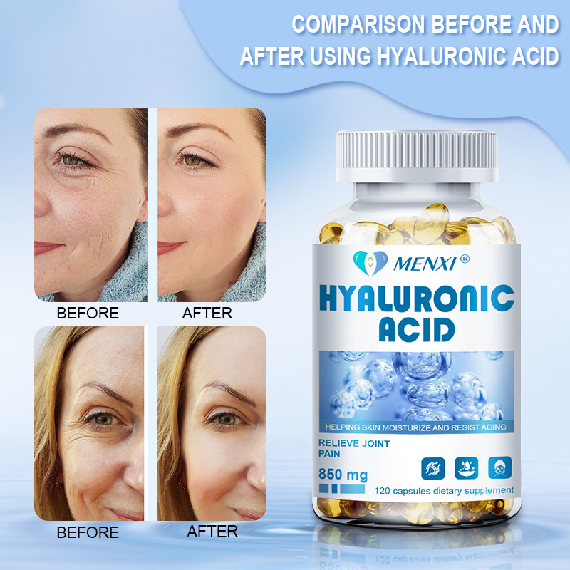 MENXI Hyaluronic Acid 120 Capsules Support Healthy Joints Help Reduce Wrinkles