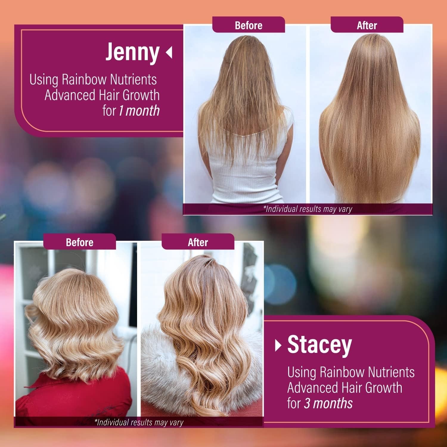 Rainbow Nutrients Advanced Hair Growth-Hair,Skin & Nail Health – Biotin,Collagen