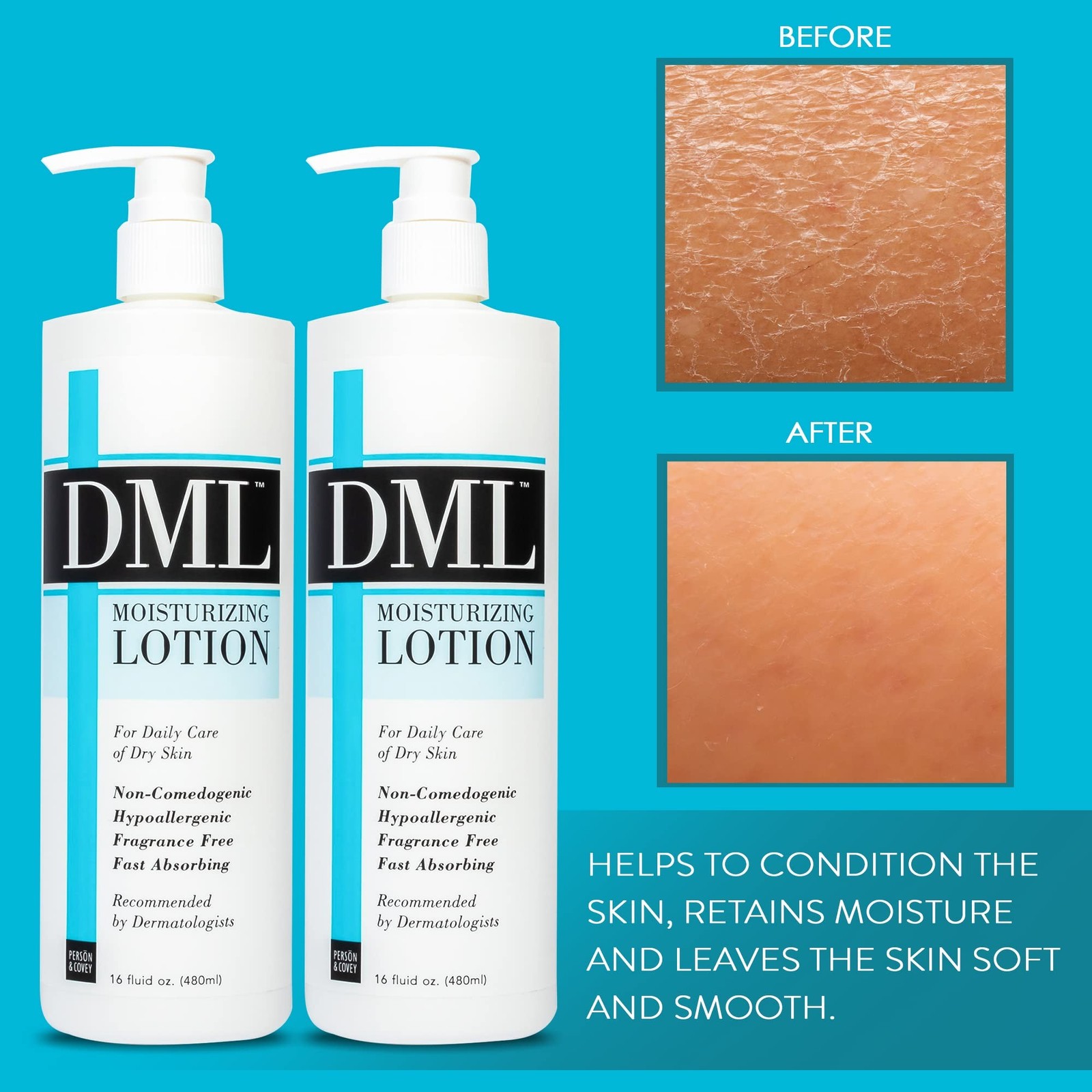 DML Moisturizing Lotion- Hydrating Hand and Body Moisturizer / Hypoallergenic…