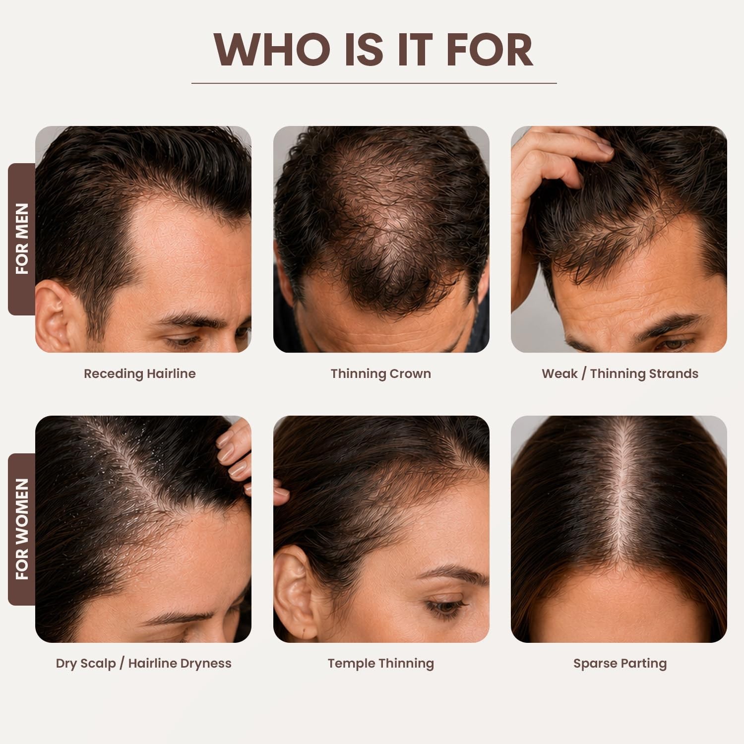 SØREN Micro Infusion Hair Renewal System by SOREN – Saw Palmetto & Pe