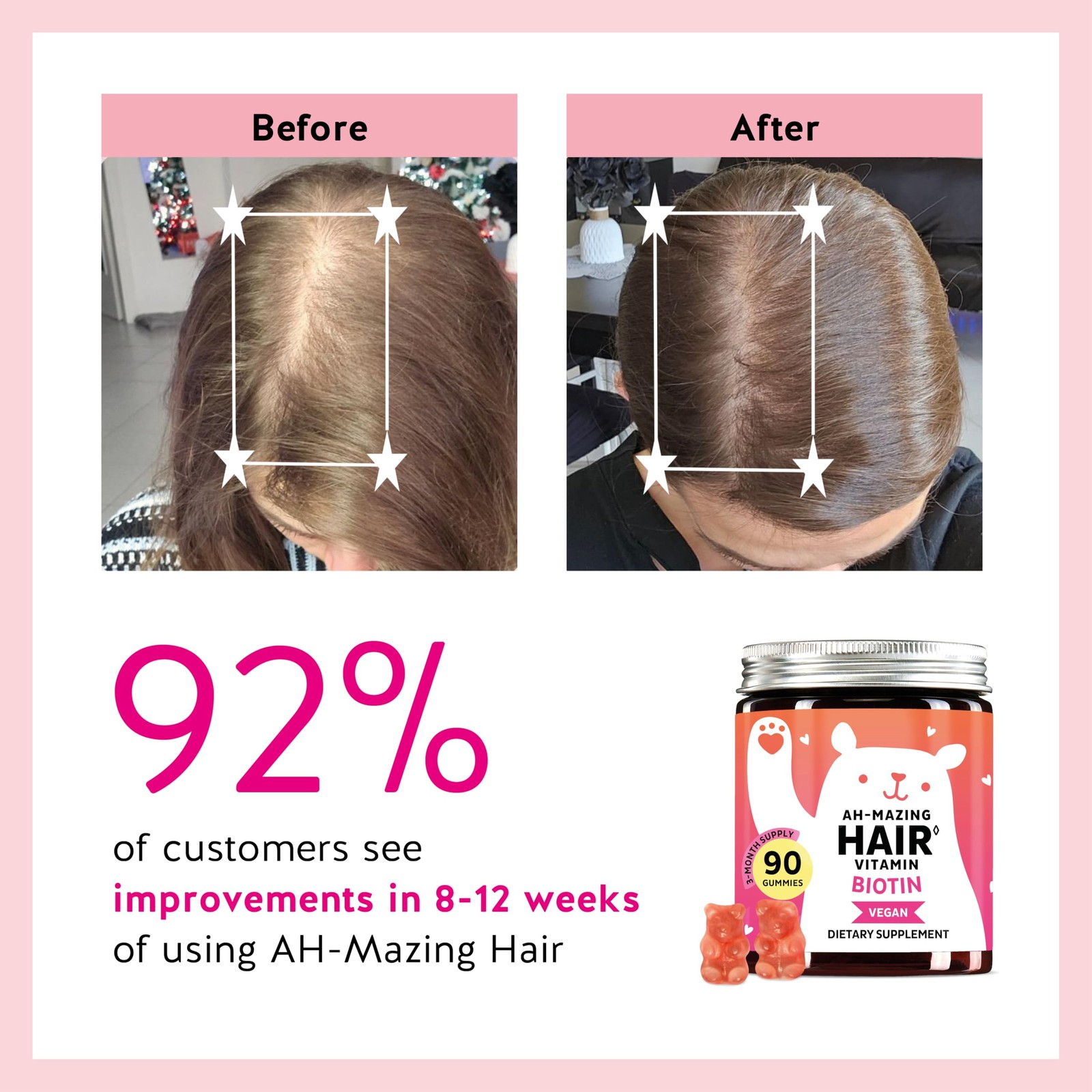 Biotin Gummies for Hair, Skin & Nails. 5,000 mcg High 30 Count (Pack of 1)
