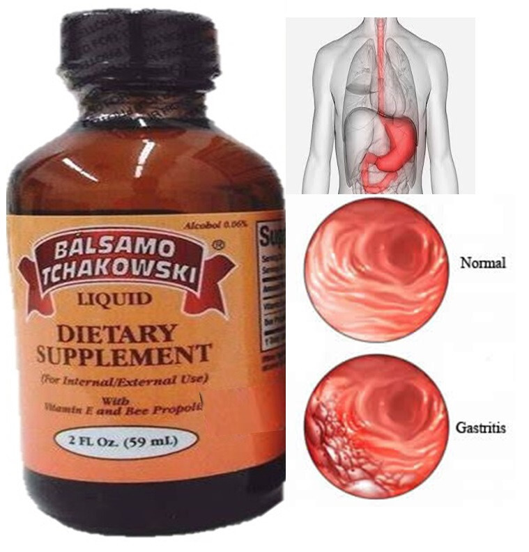 BALSAMO TCHAKOWSKI LIQUID DIETARY SUPPLEMENT 2 FL STOMACH ULCER PAIN RELIEF