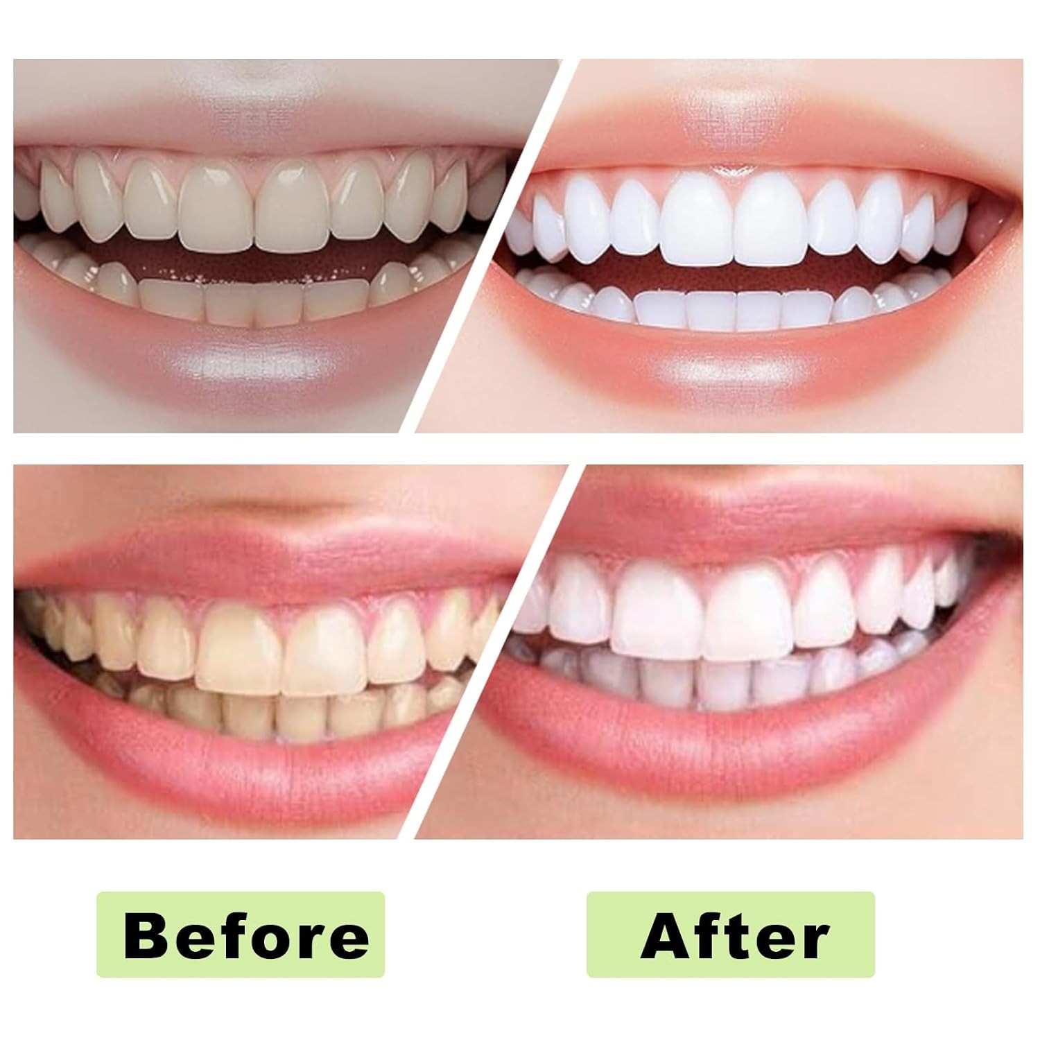 2PCS Collagen Tooth Powder,Collagen Powder for Gums, Smile Strengthening, Provid