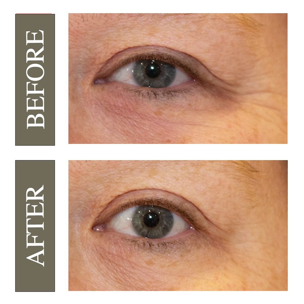 Hey Honey Open Your Eyes Lifting Eye Serum | Under 0.51 Fl Oz (Pack of 1)