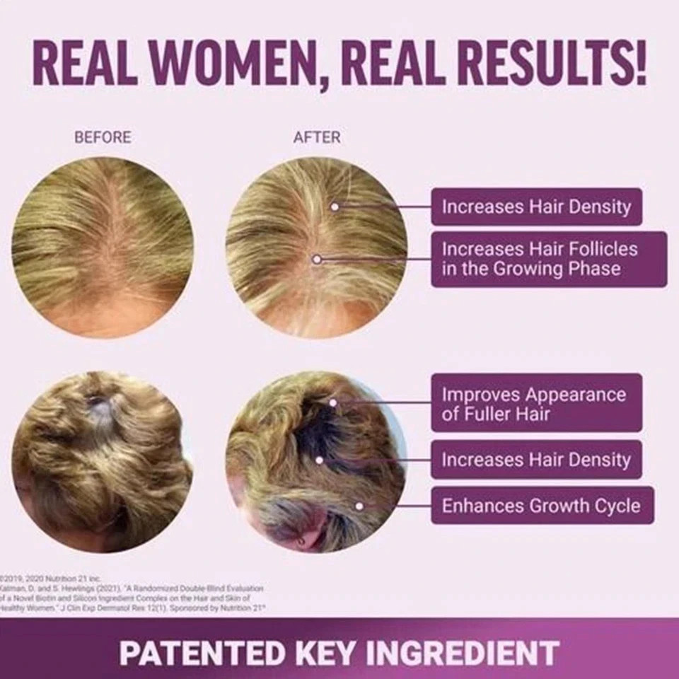 Force Factor Hair Growth Accelerator, Mixed Berry, 60 Soft Chews Free Shipping ！
