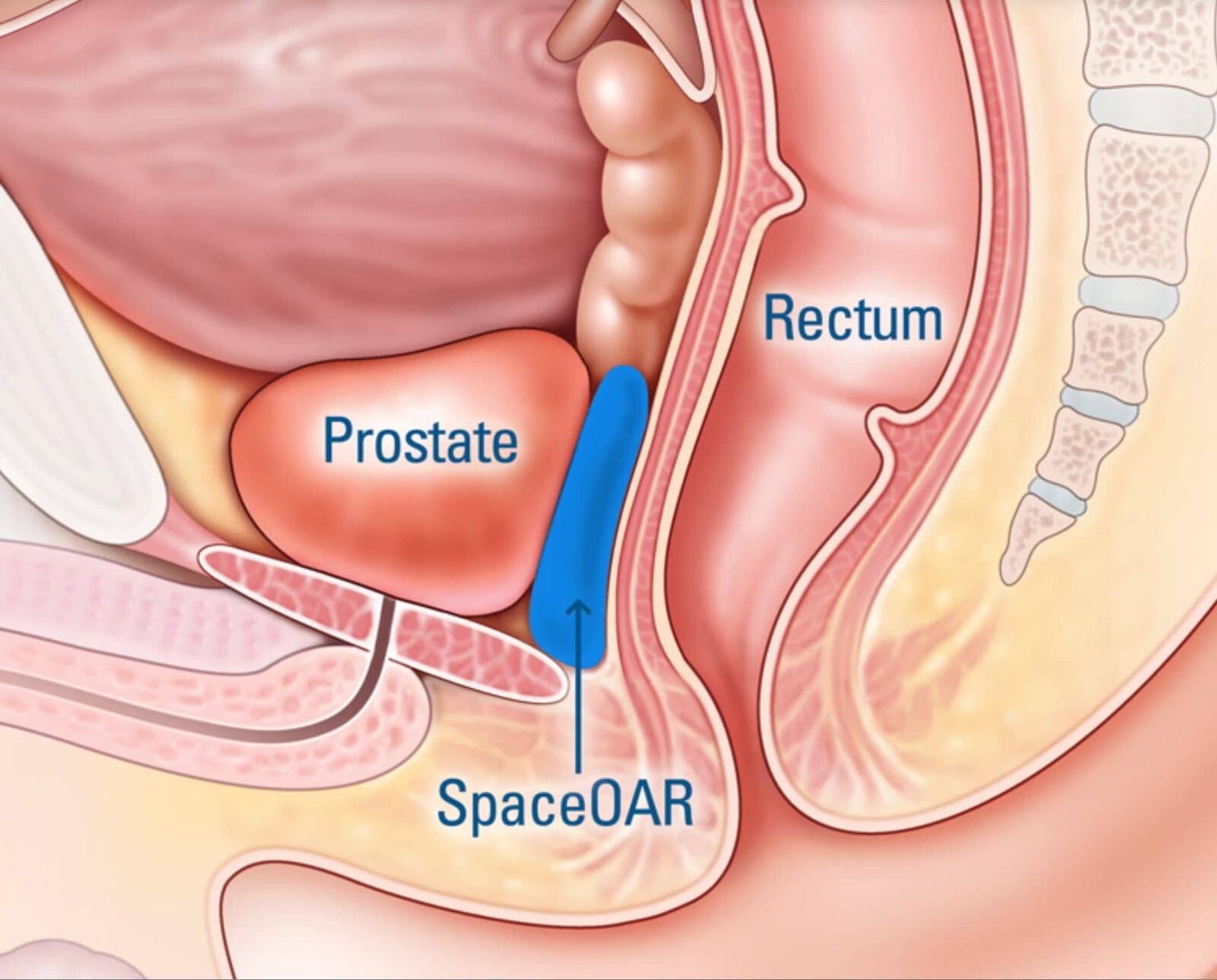 NEW Mejor tratamiento natural para desinflamar la prostata prostatitis
