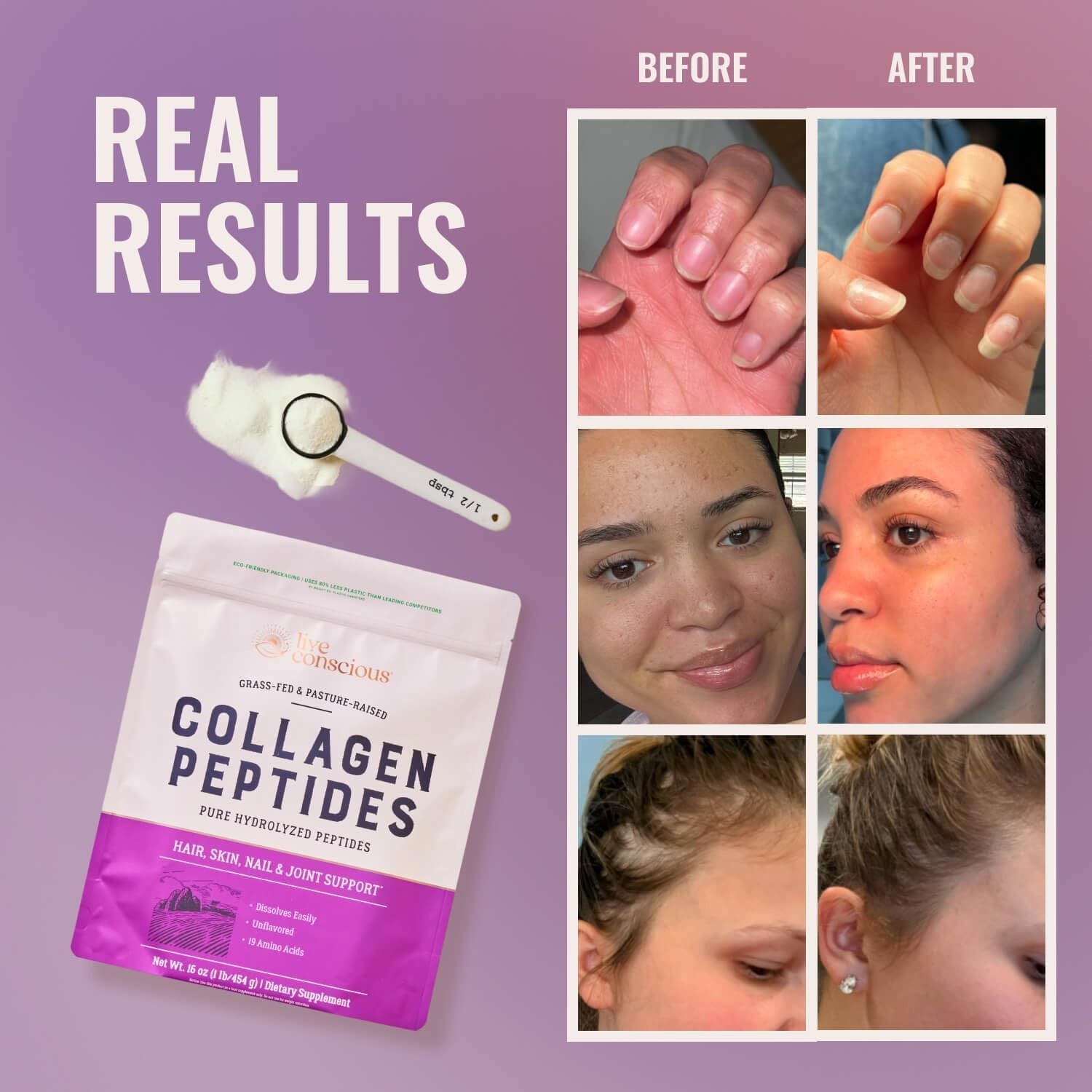 Revitalize & Shine: Naturally-Sourced Collagen Powder for Youthful Skin, Hair…