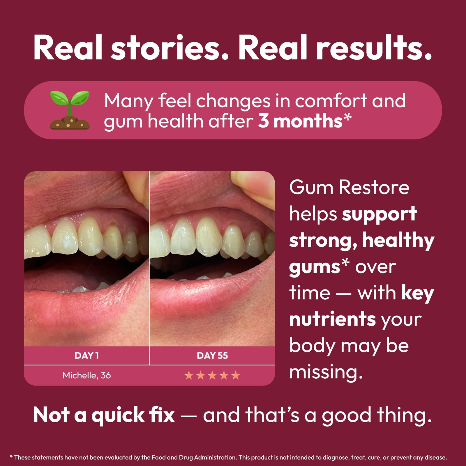 Gum Restore – Gum Repair for Receding Gums | Teeth Magnesium Supplements, Ora…