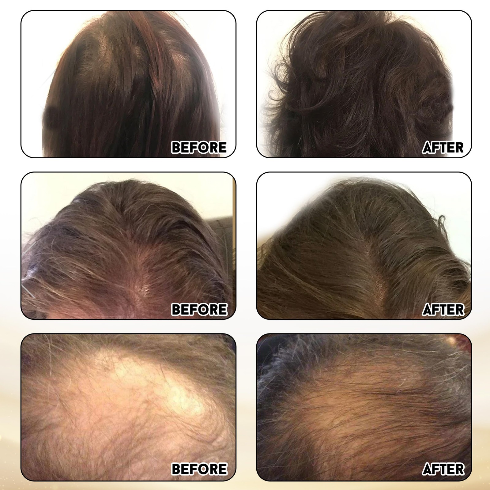 Joyce Giraud Ultimate Hair Strength Supplements 30-Day Supply, Scientifically…