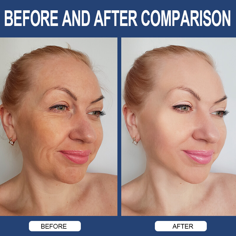 Hyaluronic Acid Capsules 850mg- Anti-Aging,Skin Hydration Healthy Joints Support