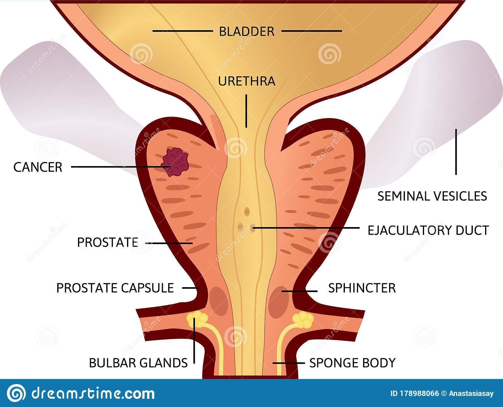 NEW Mejor tratamiento natural para desinflamar la prostata prostatitis