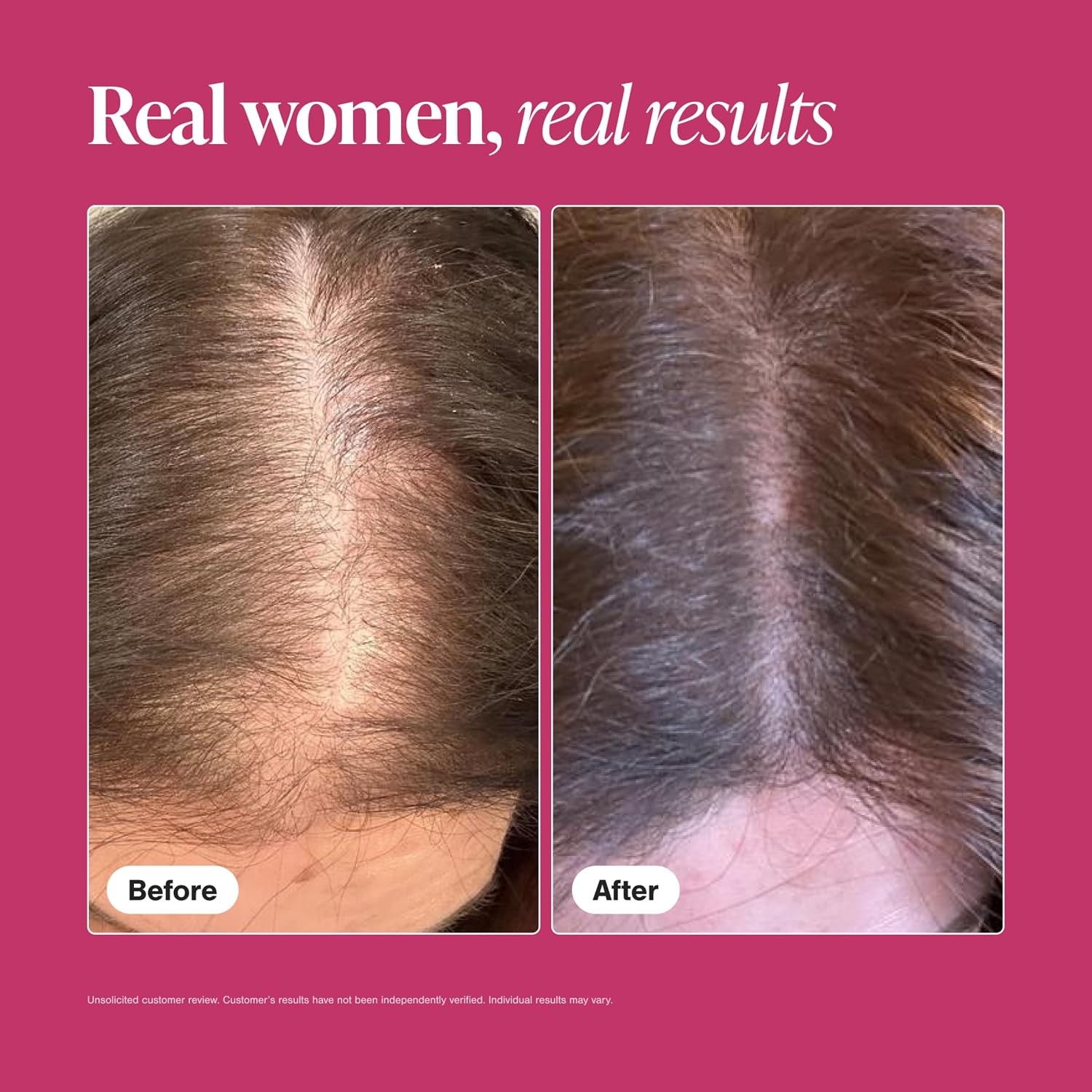1-3pack Viviscal Hair Growth Dietary Supplement with Collagen Complex 180 Tablet