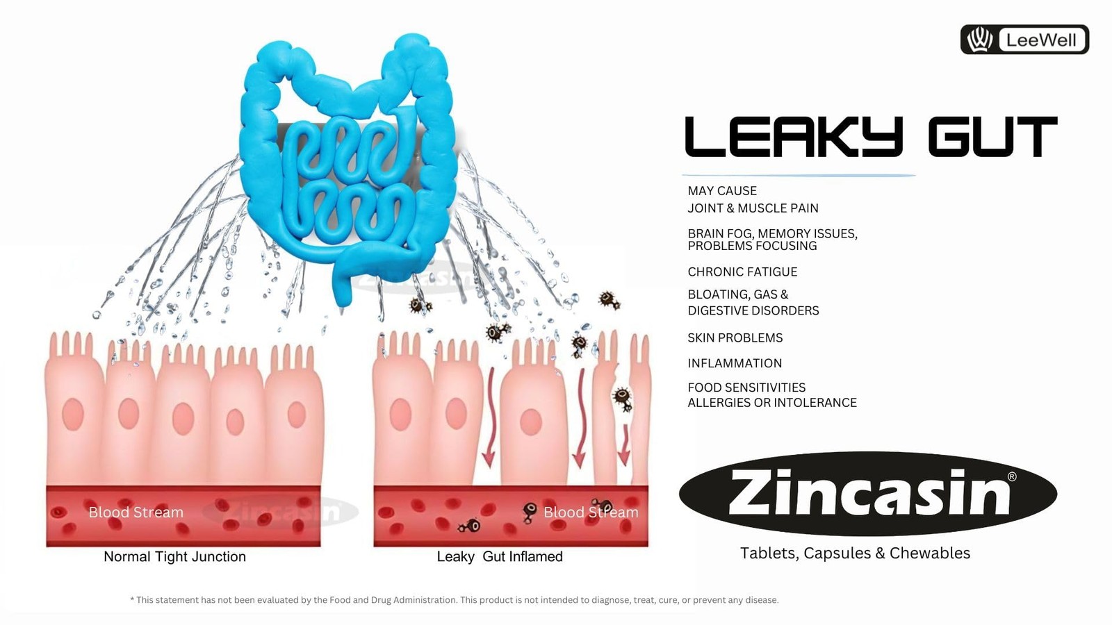 Zincasin Zinc L-Carnosine 75mg x60 | Gut, Immunity, Skin, Hair, Ulcer & IBS Supp