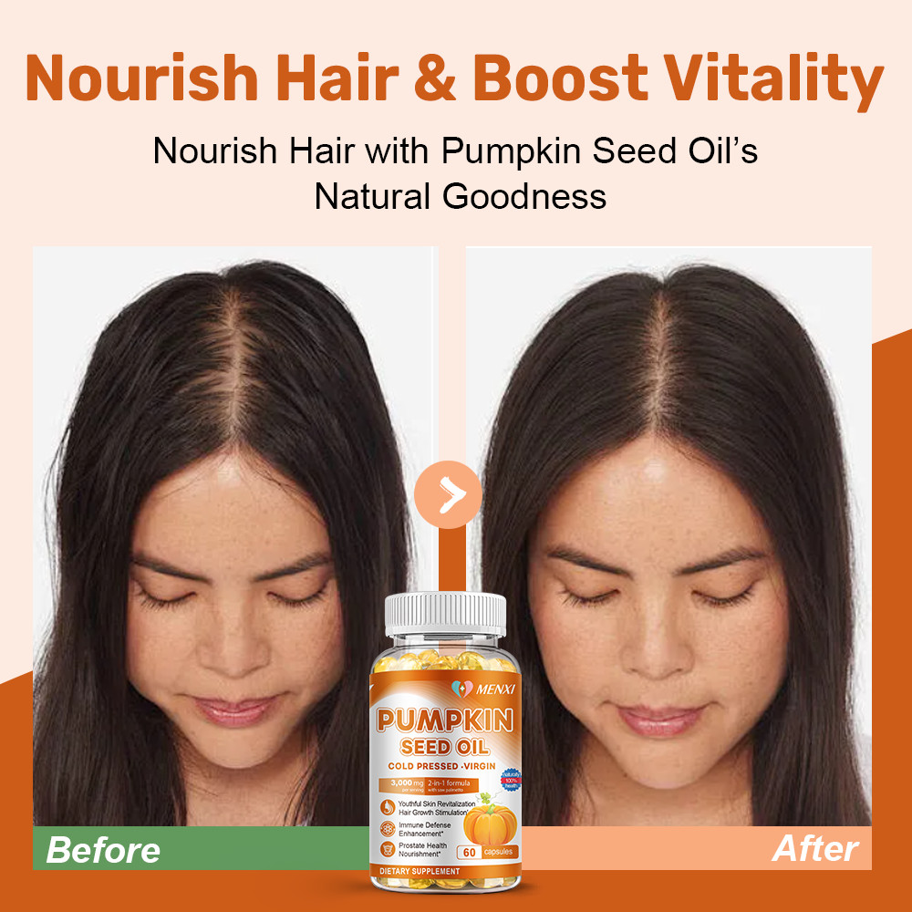 Pumpkin Seed Oil Saw Palmetto 3000mg Softgels Cold Press Virgin Oil Phytosterols