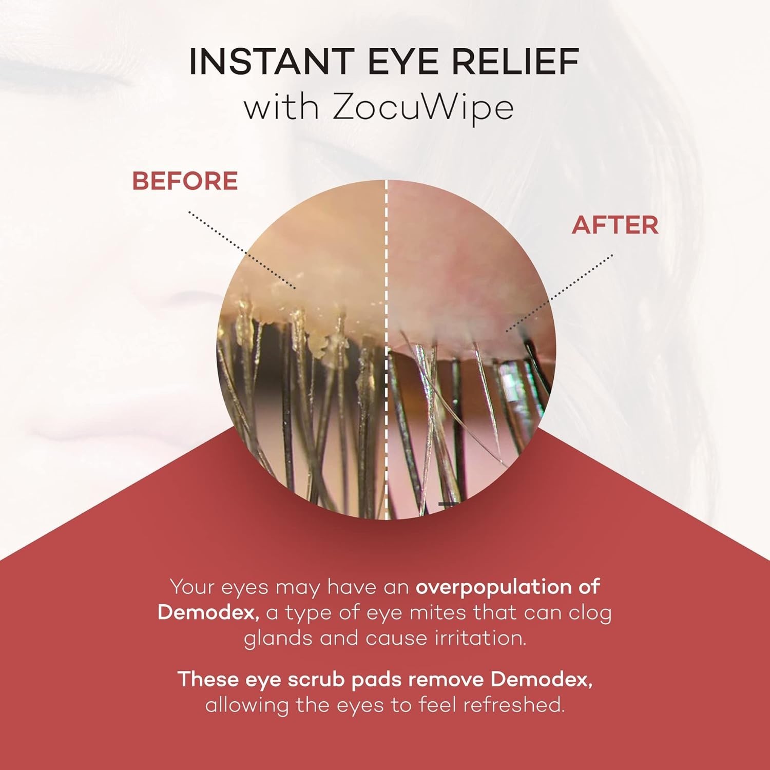 Zocular ZocuWipe Eyelid Cleansing Wipes with Natural Okra Complex – Gentle Daily