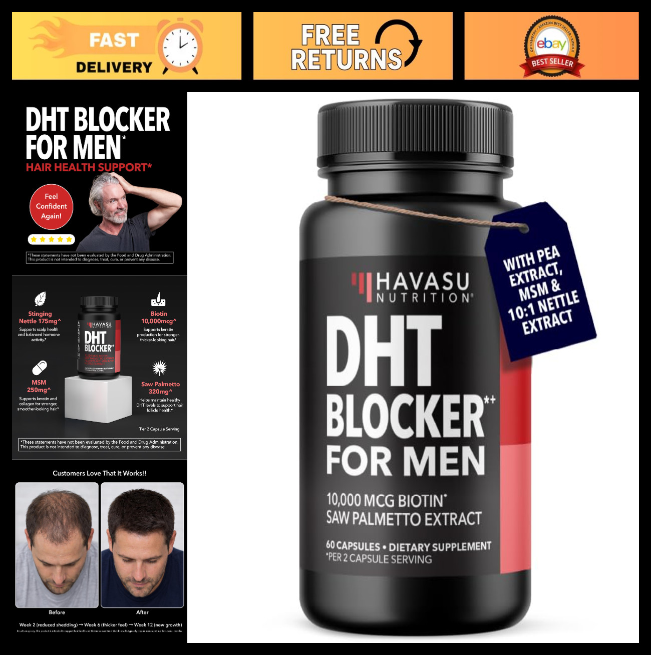 DHT Blocker for Men – Biotin 10000mcg, Saw Palmetto, MSM – Supports Hair Growth,