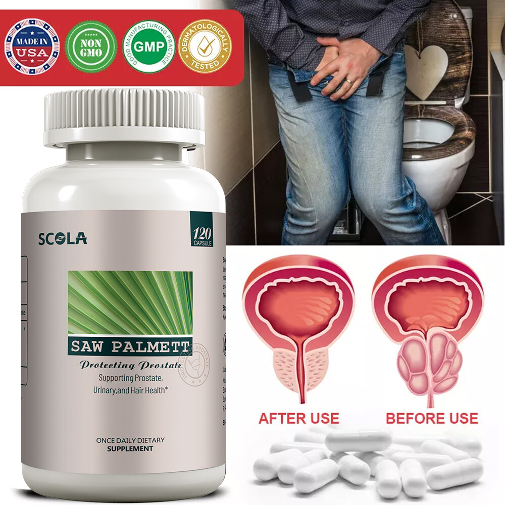 Saw Palmetto Capsules – Premium Prostate Health Support Supplement for Men 120Pc