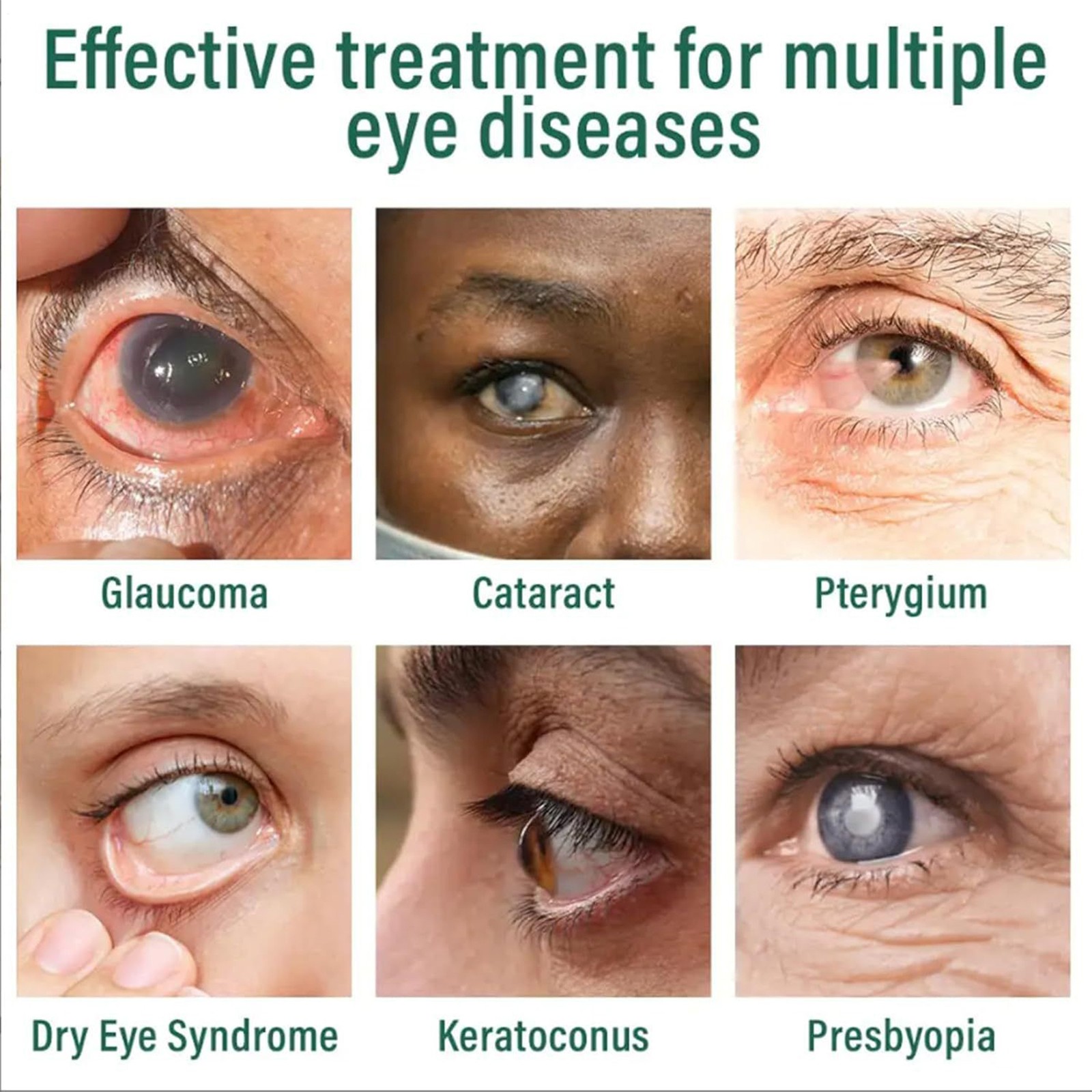Eye Health Drops Nano Eye Drop Serum Dry Eyes Moisturizing Drops Relieve Fatigue