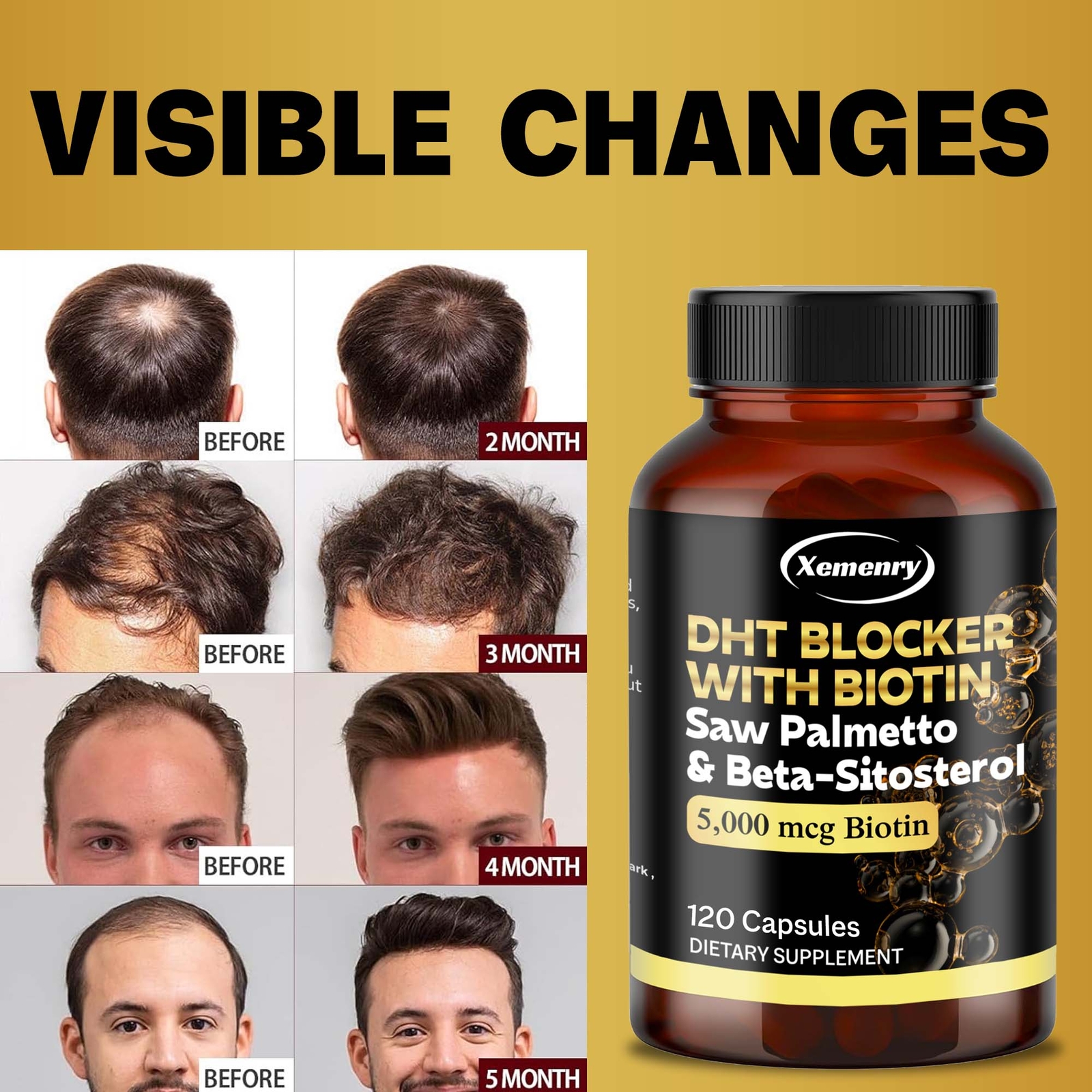 DHT Blocker – with Biotin, Promote Healthy Hair Growth and Prevent Hair Loss