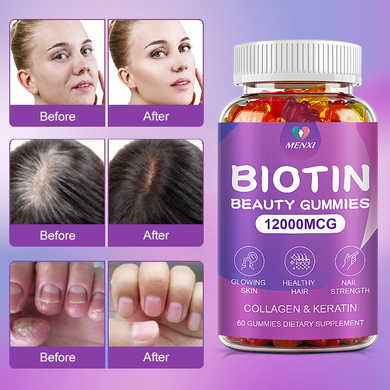 Collagen Biotin Vitamin Gummies for Hair,Skin,Nails,Premium Collagen Supplement
