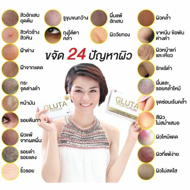 2X Gluta Frosta Plus Aura Whitening L-Glutatathione Reduce Dark Spots 30 Capsule