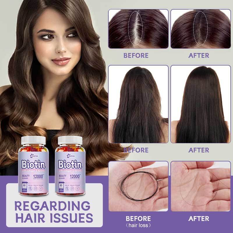 Biotin Gummies 12000 mcg for Healthy Hair, Skin & Nails Gummies with Vitamin