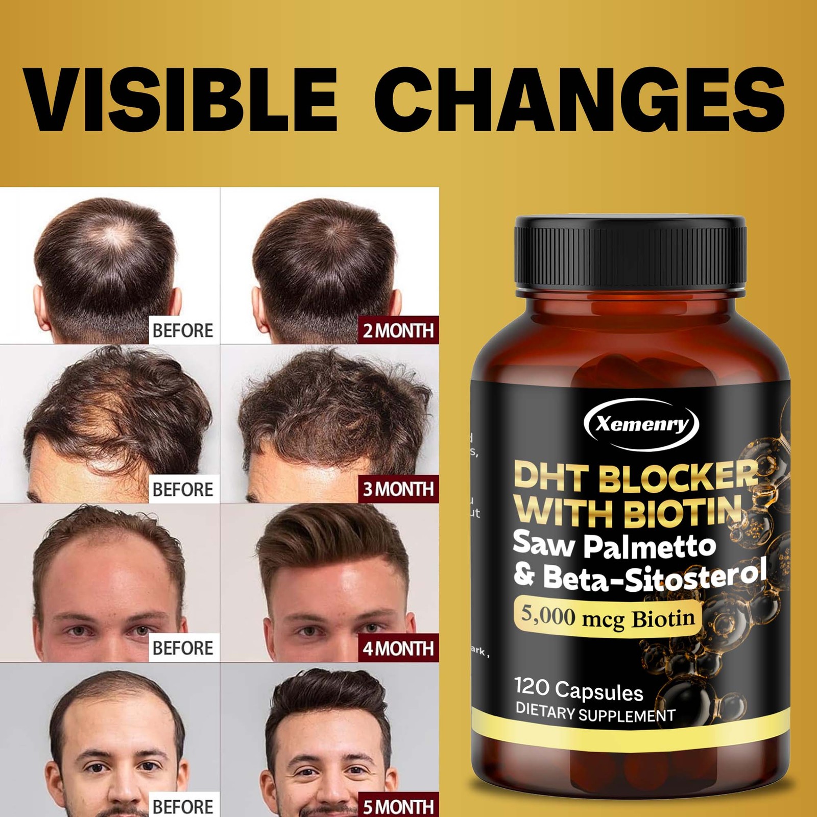 120pcs DHT Blocker – Biotin, Saw Palmetto, Beta-sitosterol – Boosts Hair Growth