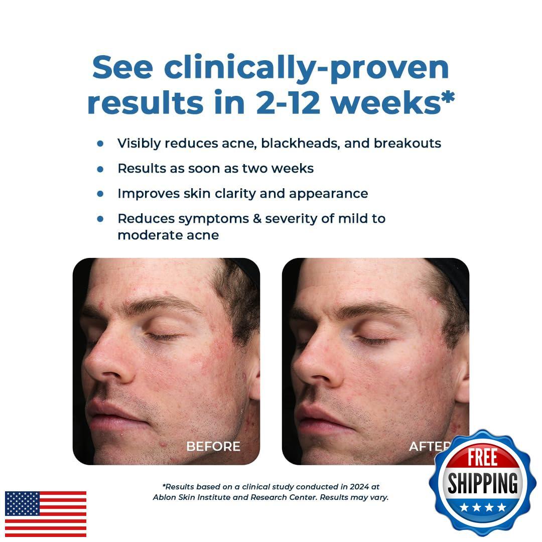 VitaMedica Clear Skin Vitamin Formula | Noncystic Acne Supplement for Skin Cl
