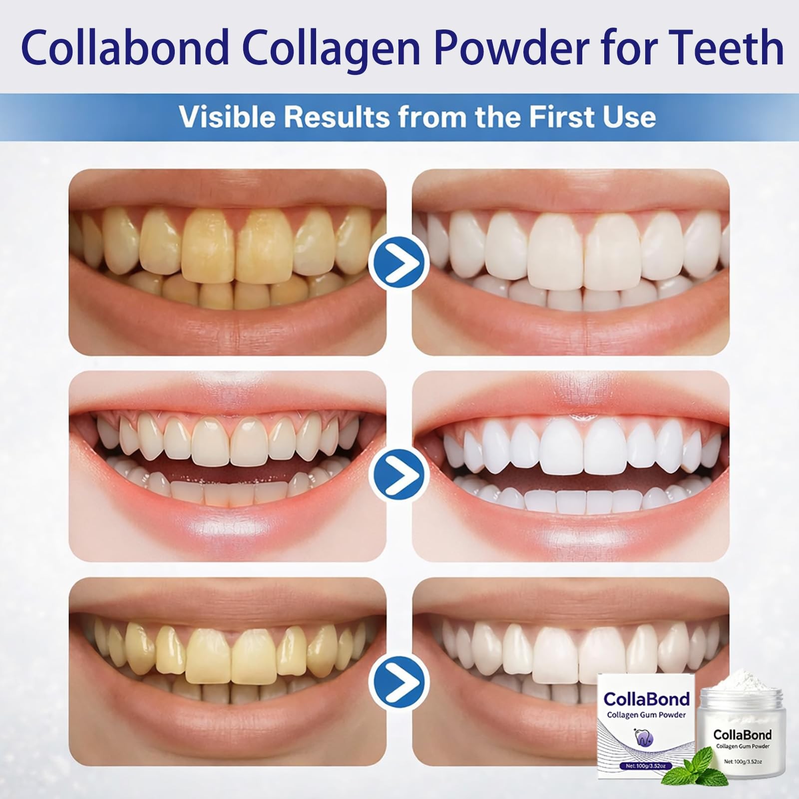Collagen Powder for Gums, Collagen Brushing Tooth Powder with Nano-Hydroxyapa…