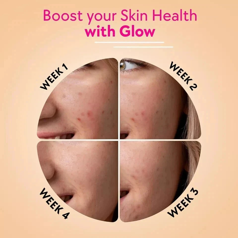 Chicnutrix Glow- 10 Effervescent Tablet Japanese Glutathione Antioxidants pack 1